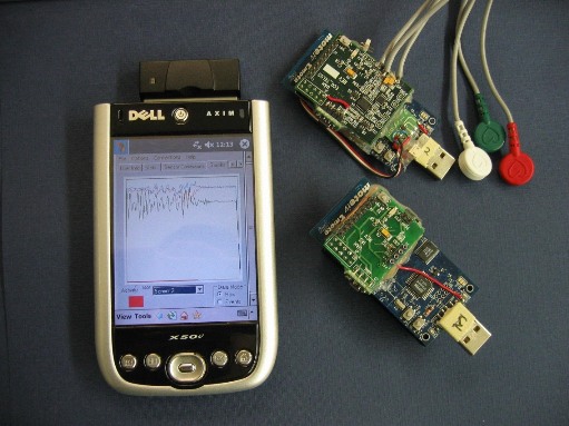WBAN prototype